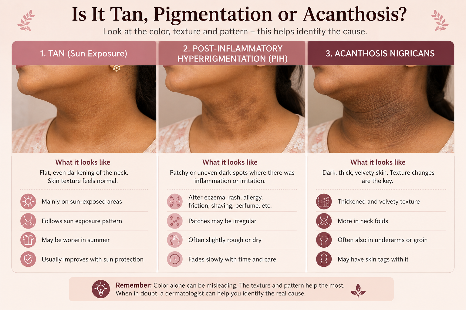 Comparison of neck tanning post inflammatory hyperpigmentation and acanthosis nigricans