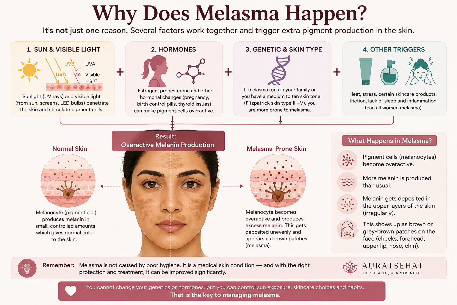 Why melasma happens including sunlight hormones and genetic susceptibility
