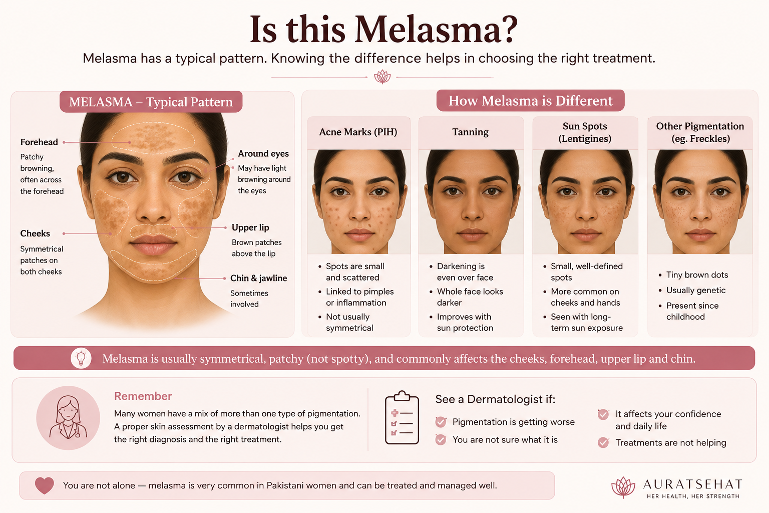 Melasma pattern compared with acne marks tanning sun spots and freckles
