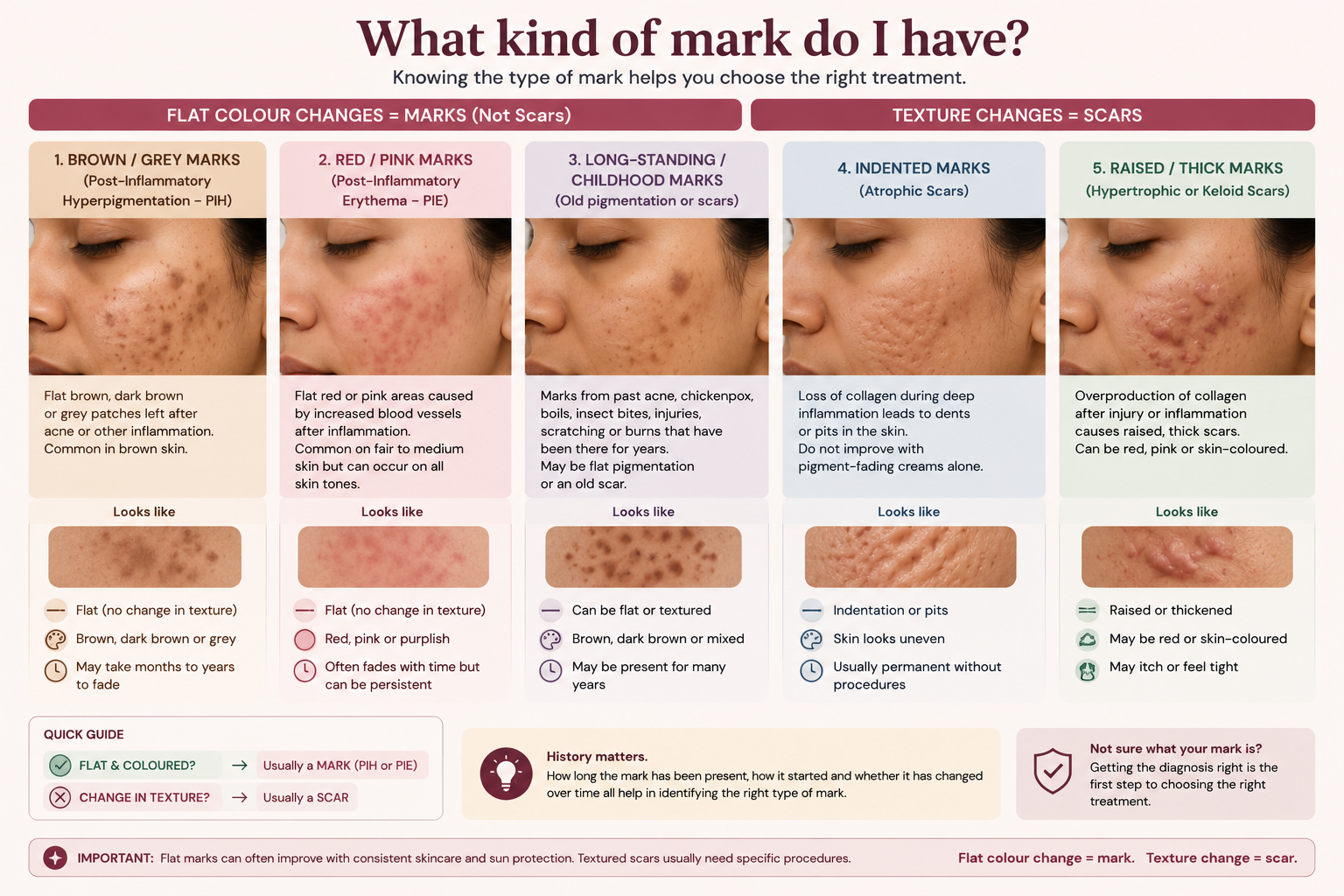 Different types of acne marks including pigmentation, erythema and acne scars