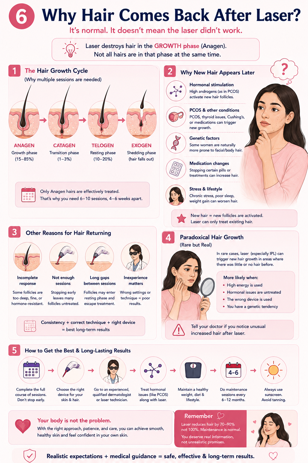 Why hair comes back after laser hair removal, including hair growth cycles, PCOS, maintenance sessions and paradoxical hair growth
