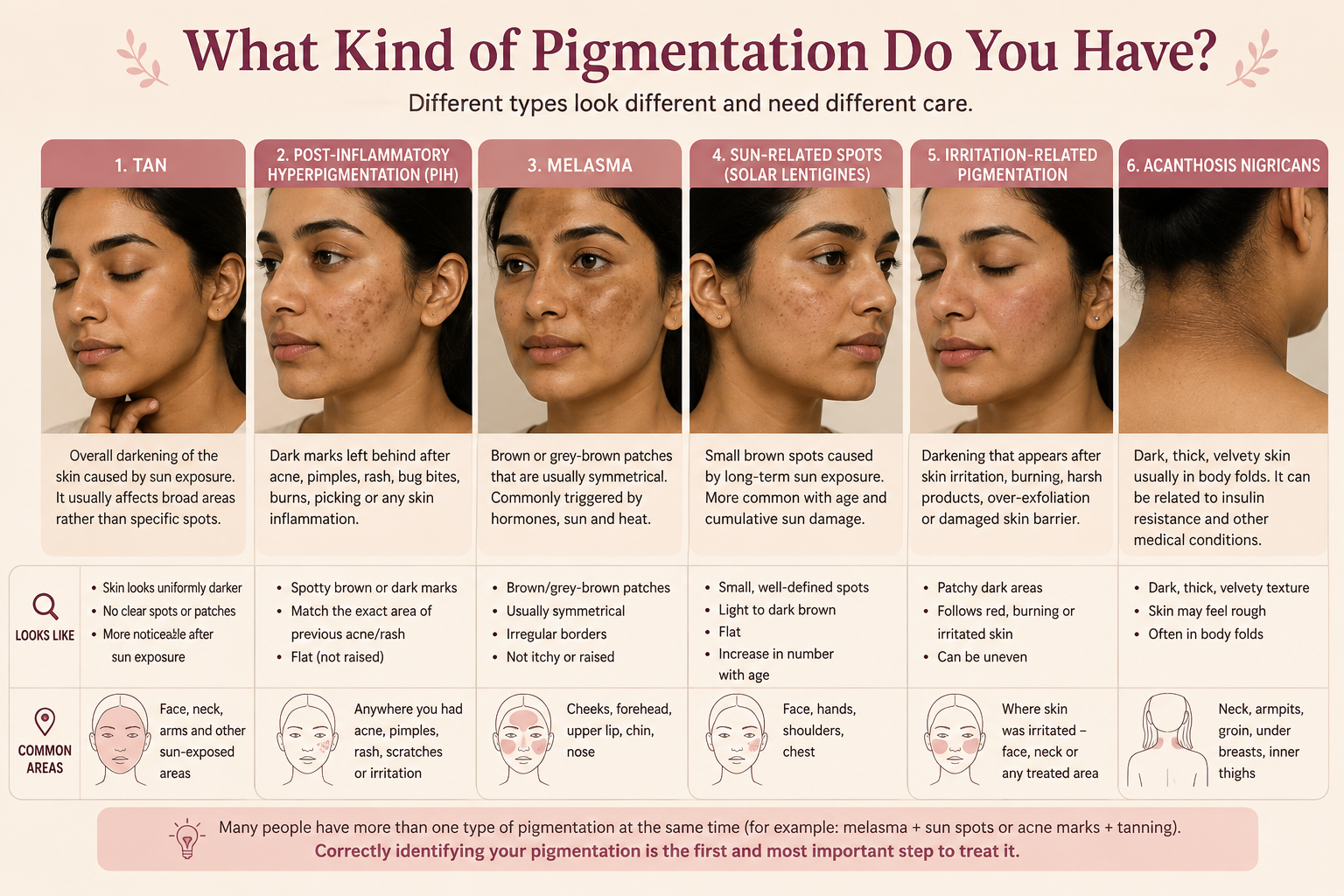 Different types of hyperpigmentation including tanning, post-inflammatory hyperpigmentation, melasma, sun spots, irritation pigmentation and acanthosis nigricans