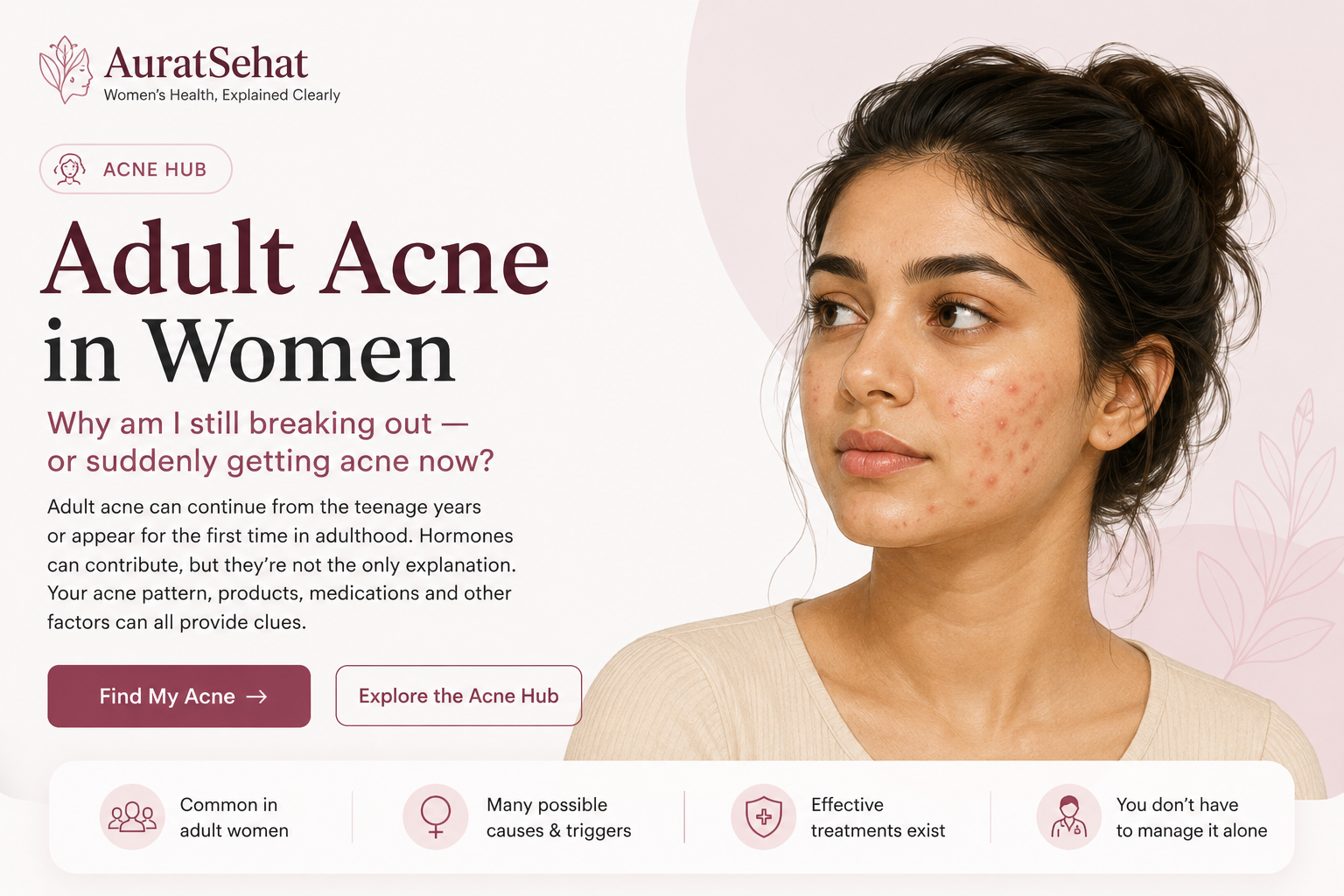 Adult acne in women