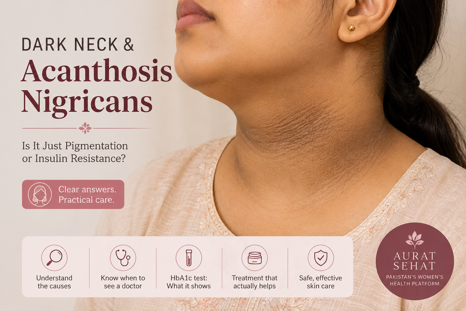 South Asian woman with dark thickened neck skin suggestive of acanthosis nigricans