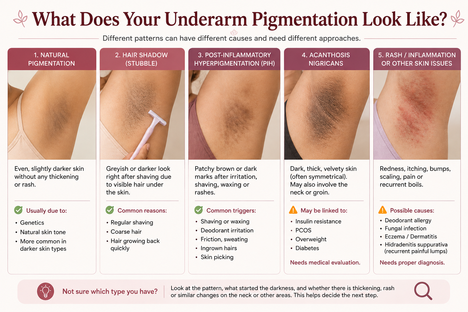 Different patterns of dark underarms including natural pigmentation shaving shadow PIH acanthosis nigricans and rash