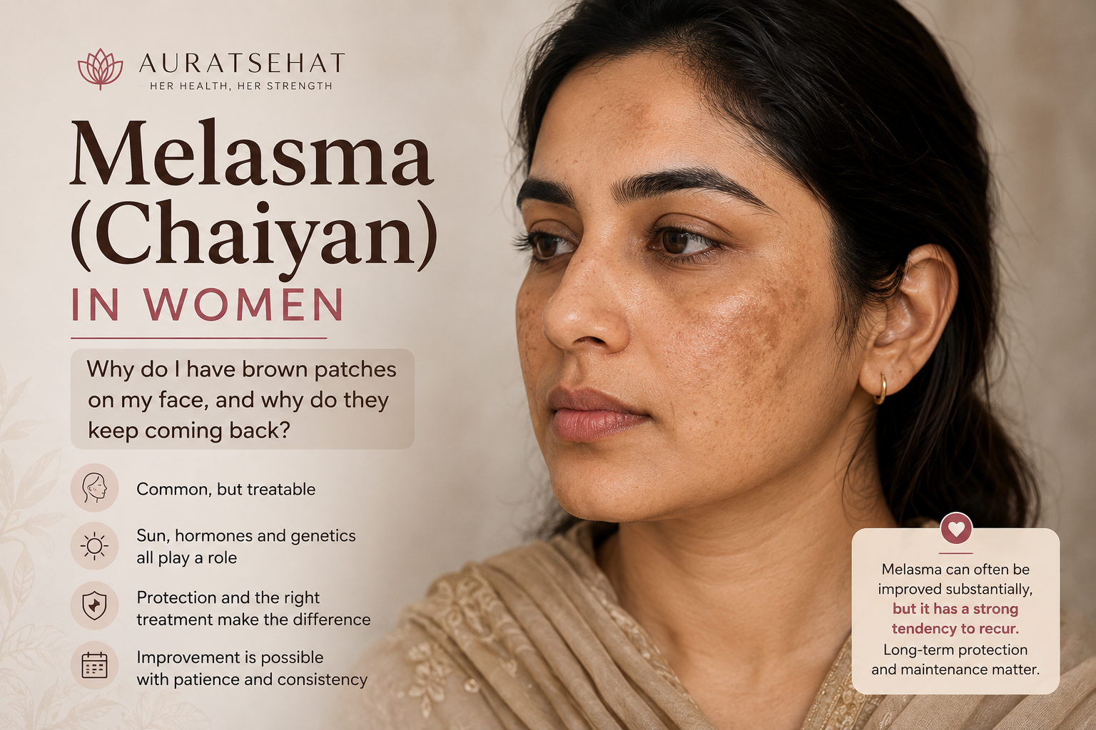 Melasma or chehre ki chaiyan in a South Asian woman