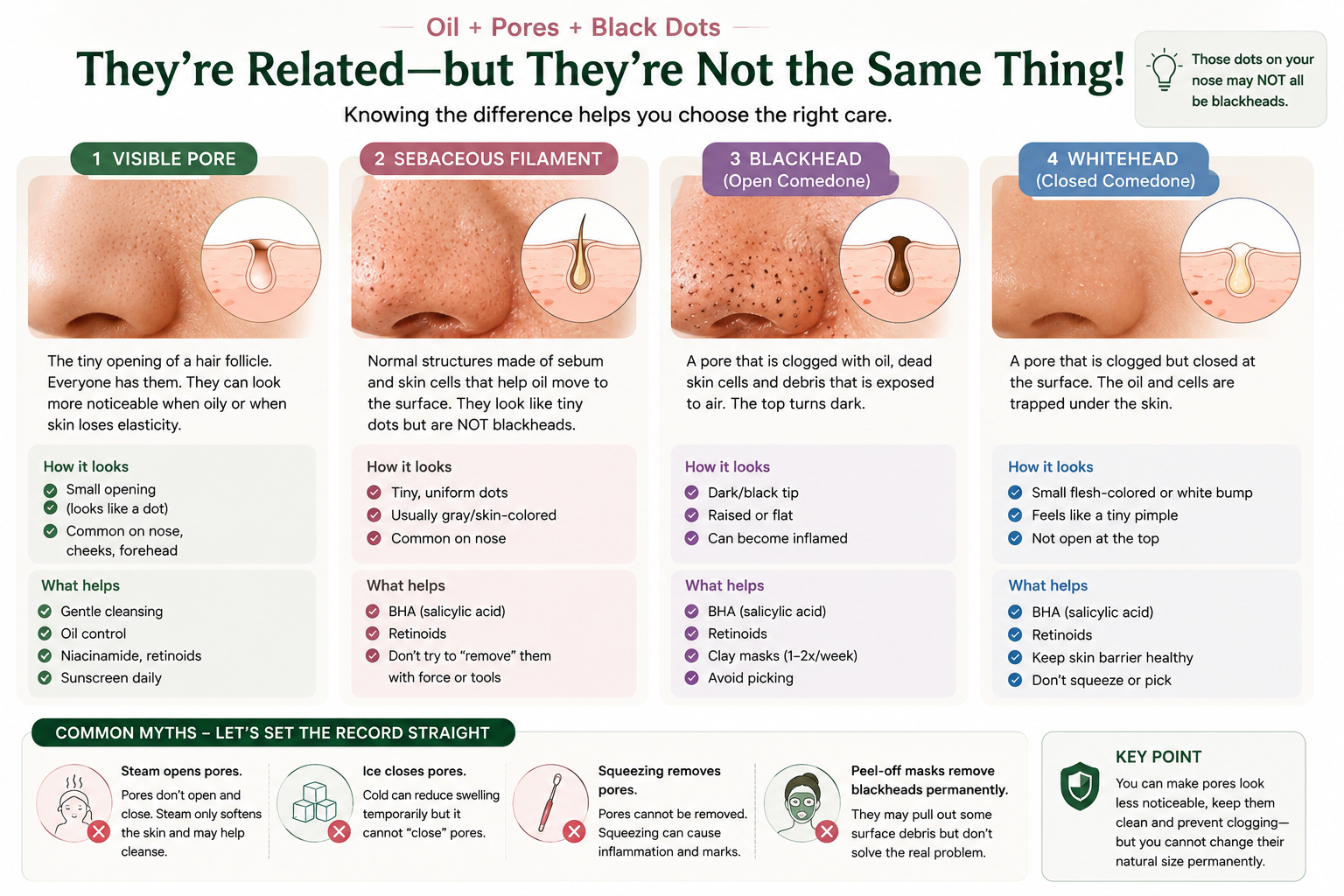 Comparison of visible pores, sebaceous filaments, blackheads and whiteheads on oily skin, including how they differ and what helps.