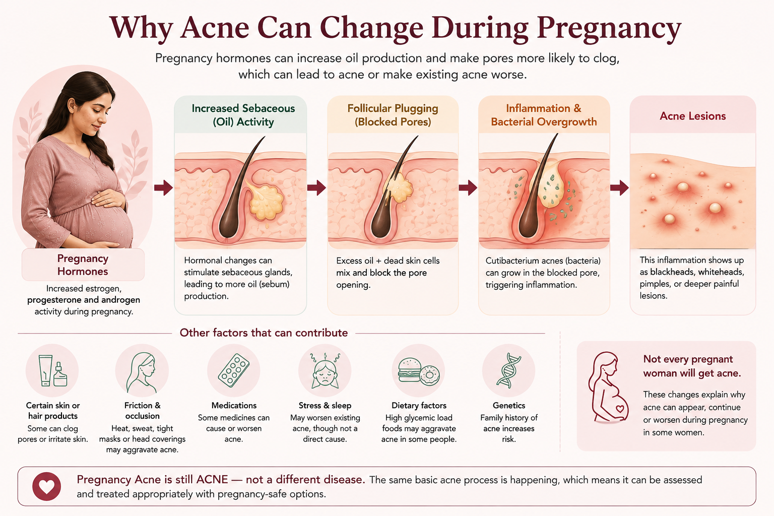 Why acne can change during pregnancy