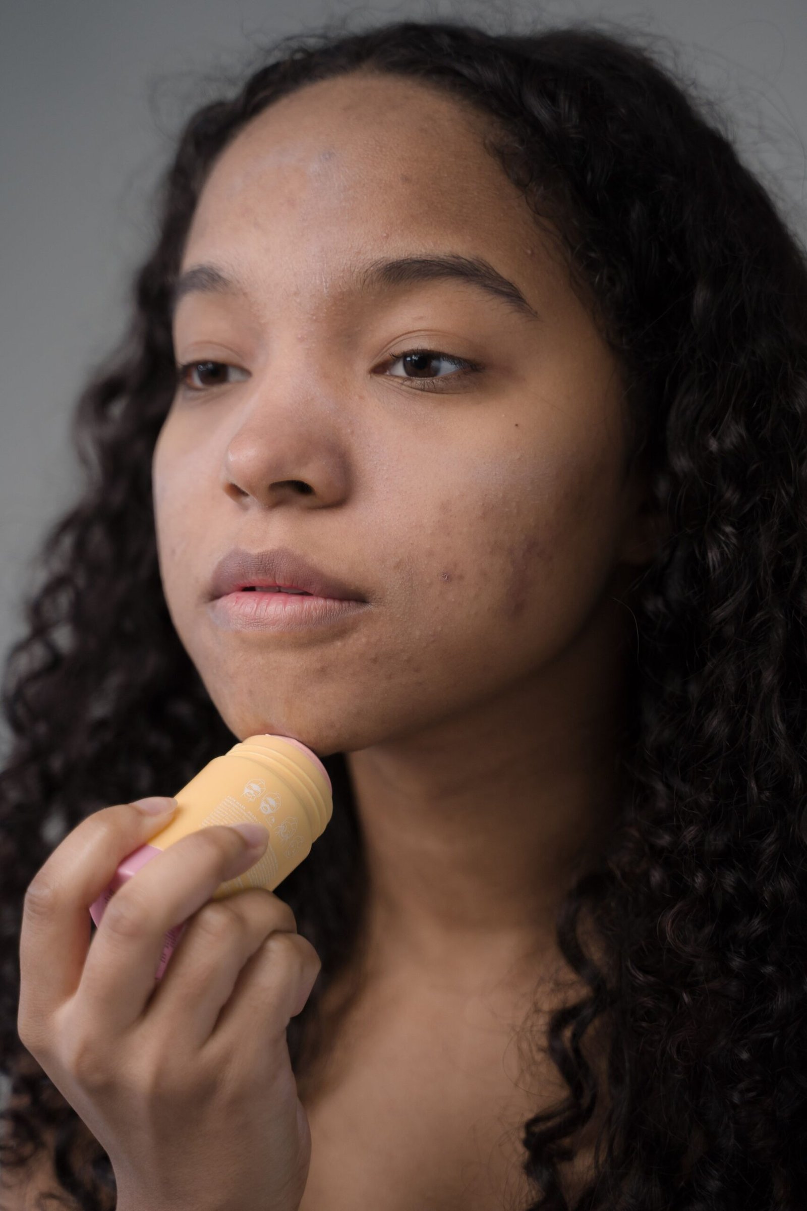 Acne and skin care